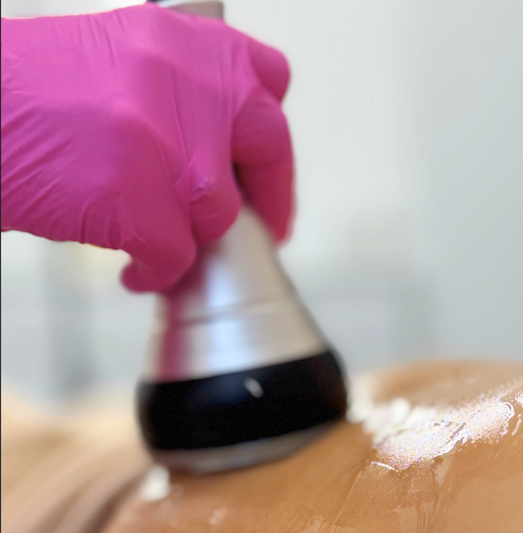 zabieg liposukcja kawitacyjna głowica na skórze